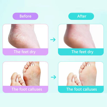 foot care kit