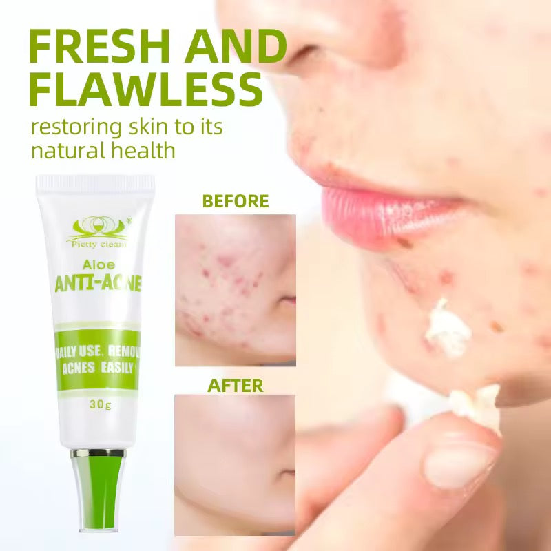 Anti-acne cream